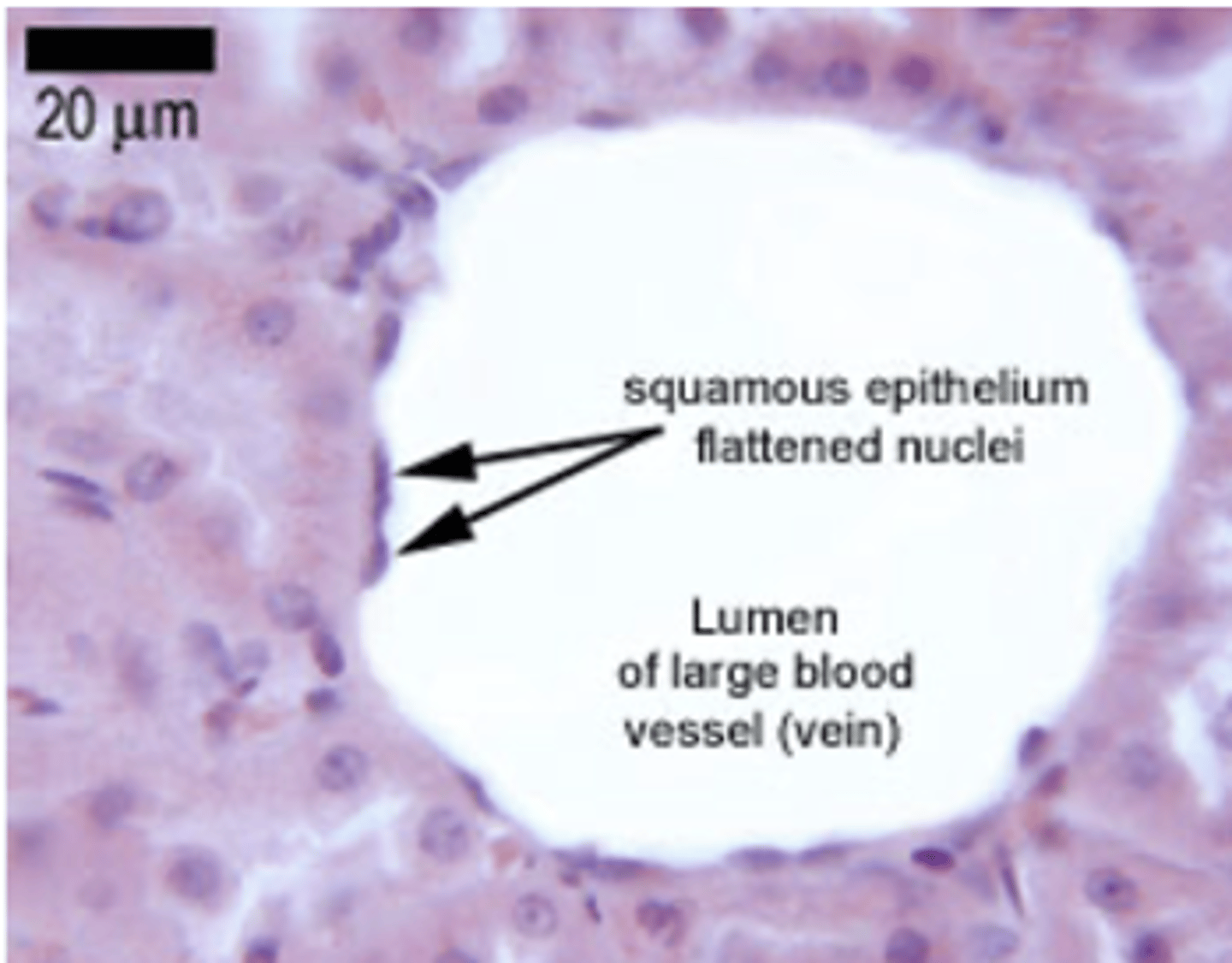 <p>simple squamous epithelium</p>