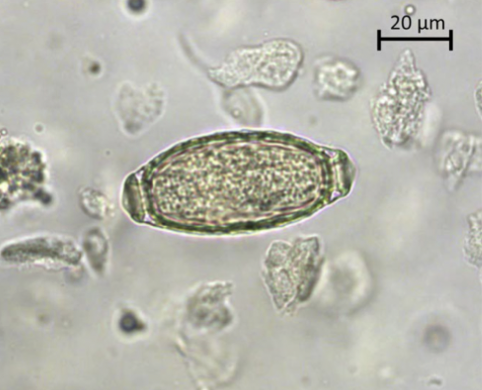 <p>Which parasite egg is shown in the image?</p>