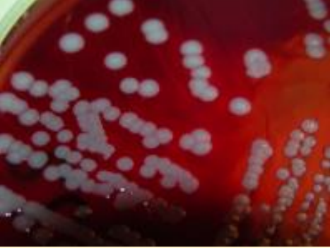 <p>What does this image show?</p>