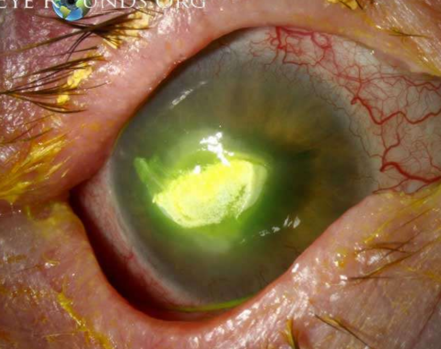<p>What condition is this?</p>