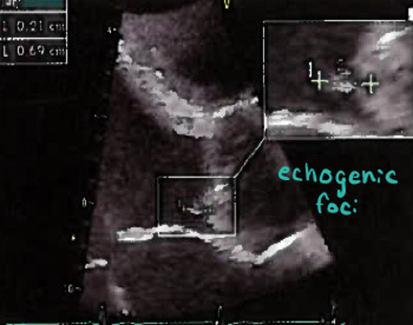 <p>What does this image represent</p>