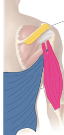 <ul><li><p>Extends arm</p></li><li><p>extends forearm</p></li></ul><p><strong>PINK</strong></p>