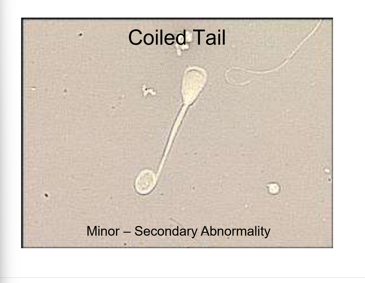 <p>Abnormality and significance?</p>