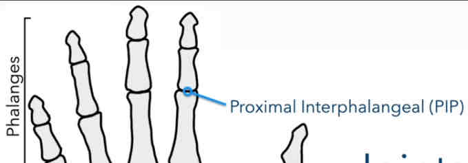 <p>Between the proximal phalanges and middle phalanges</p>