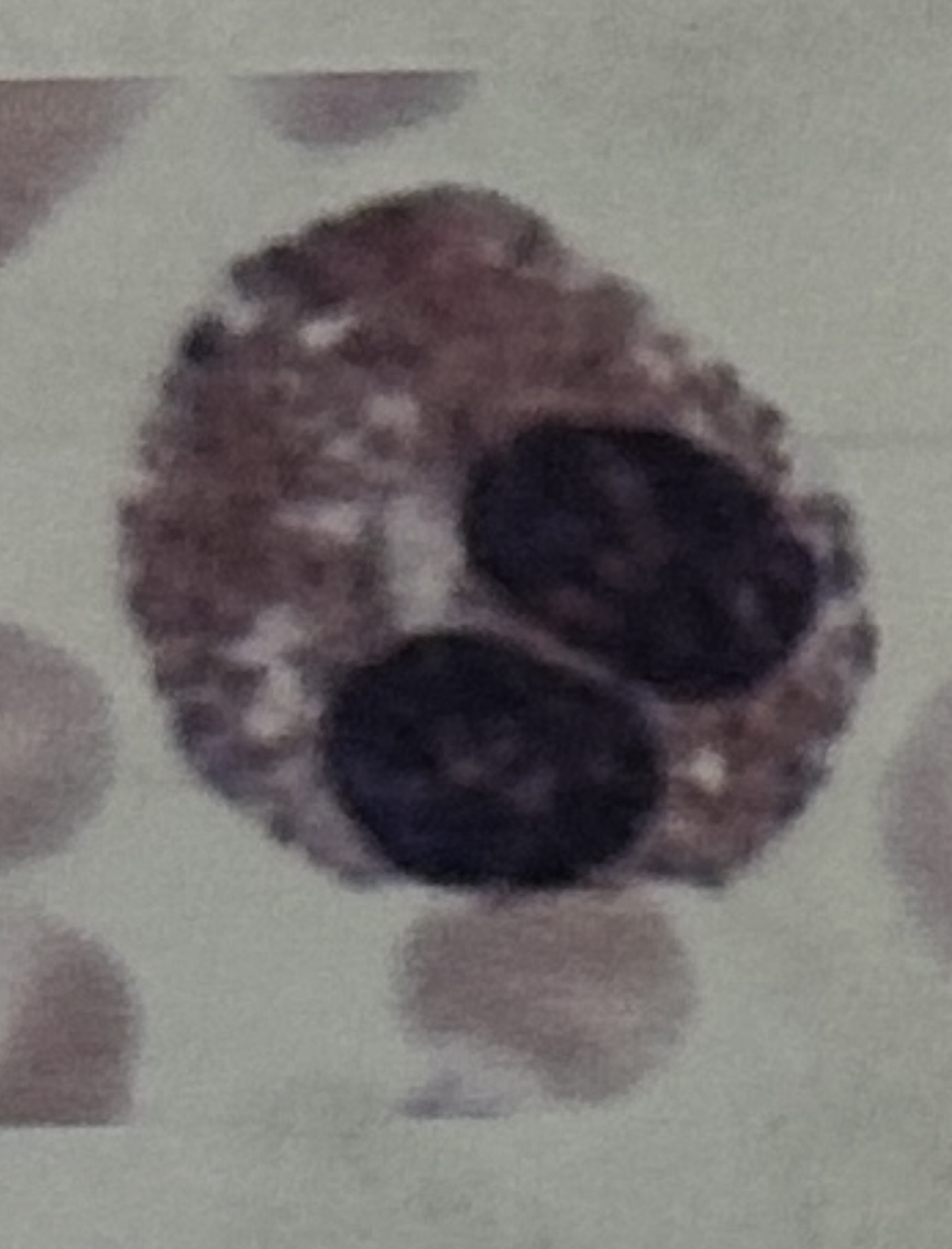 <p>WBC</p>