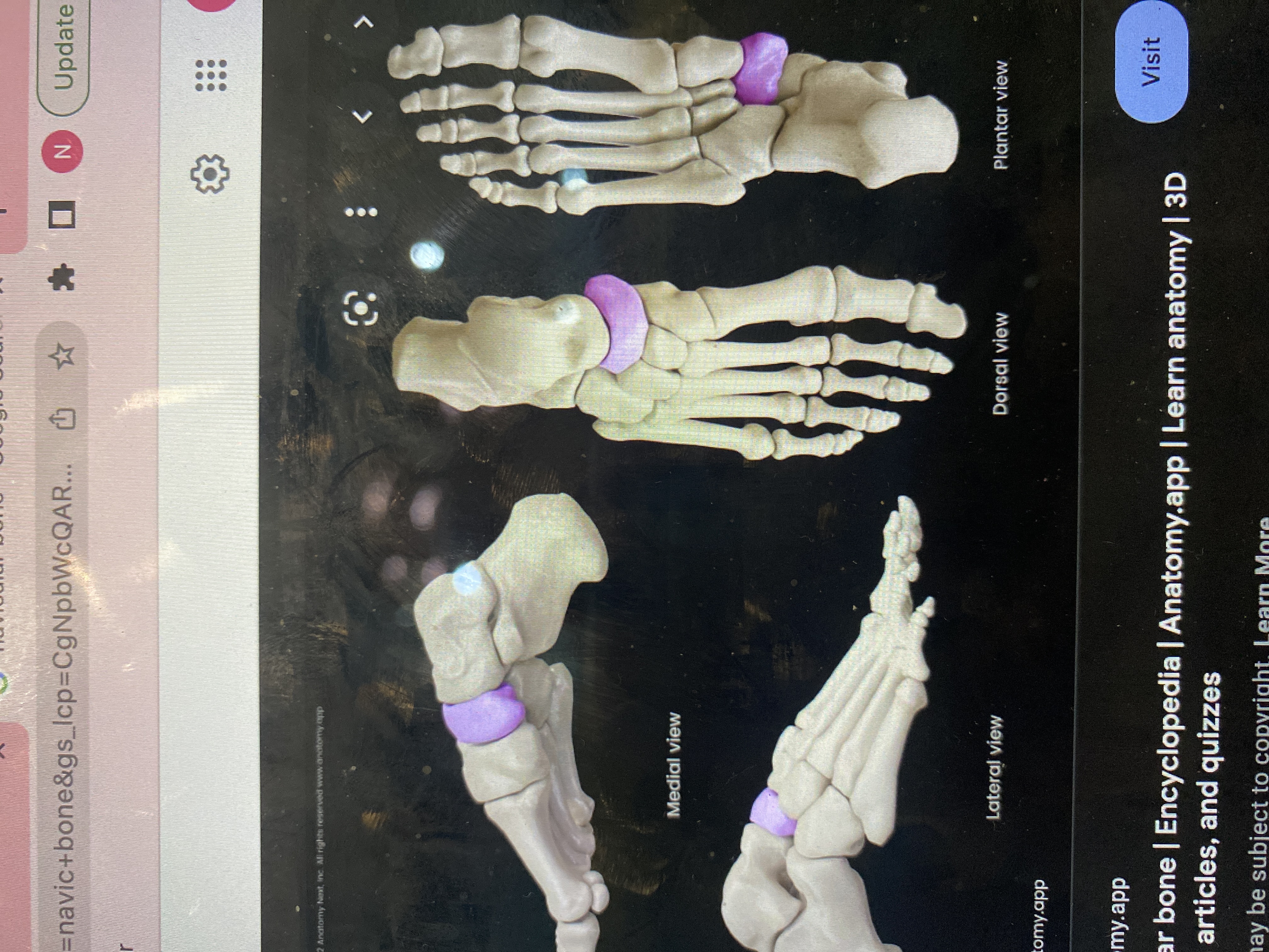 What is the purple bone? 