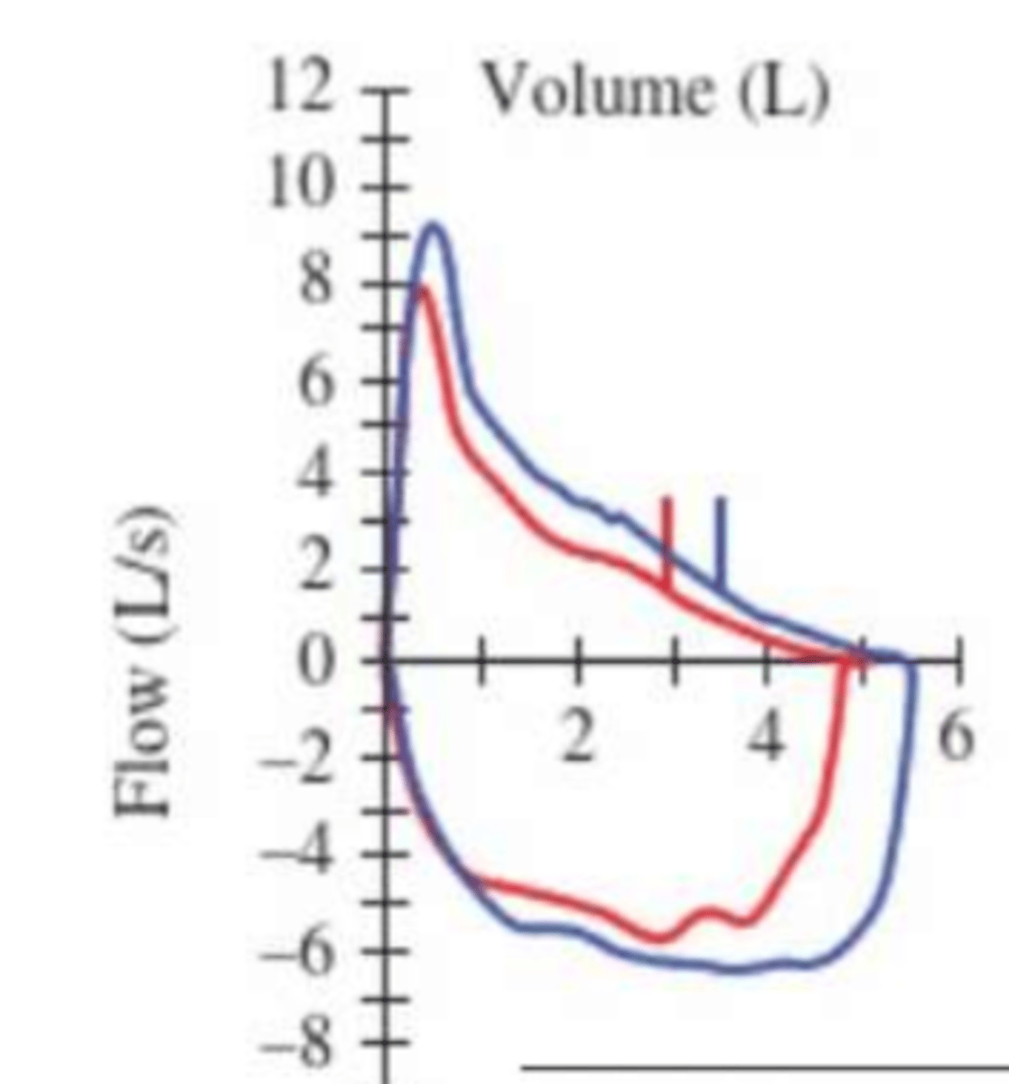 <p>What change pre and post bronchodilator administration is indicative of reversible airway obstruction and in support of asthma diagnosis?</p>