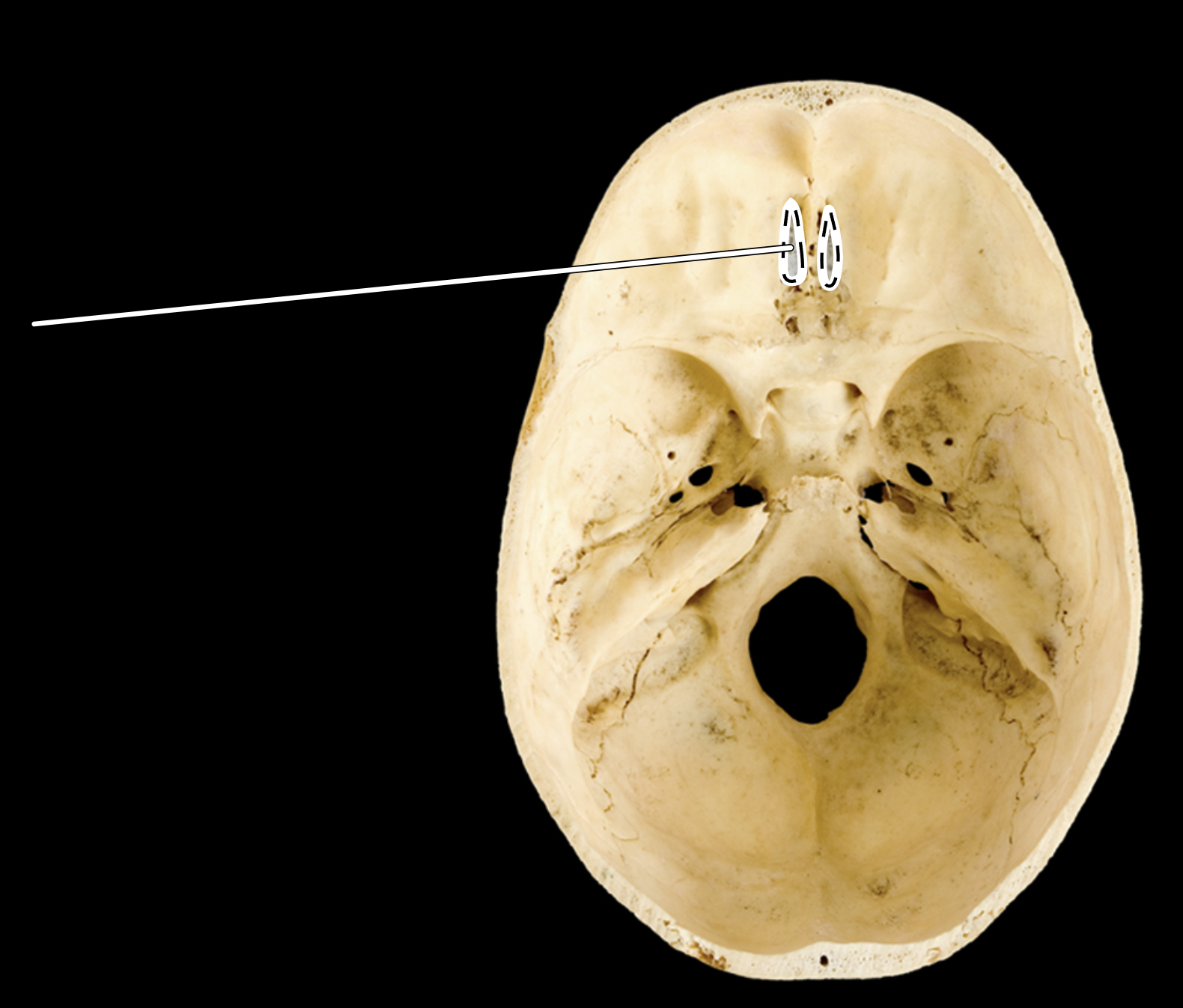 <p>Name the highlighted portion.</p><p>(Superior view of cranial cavity).</p>