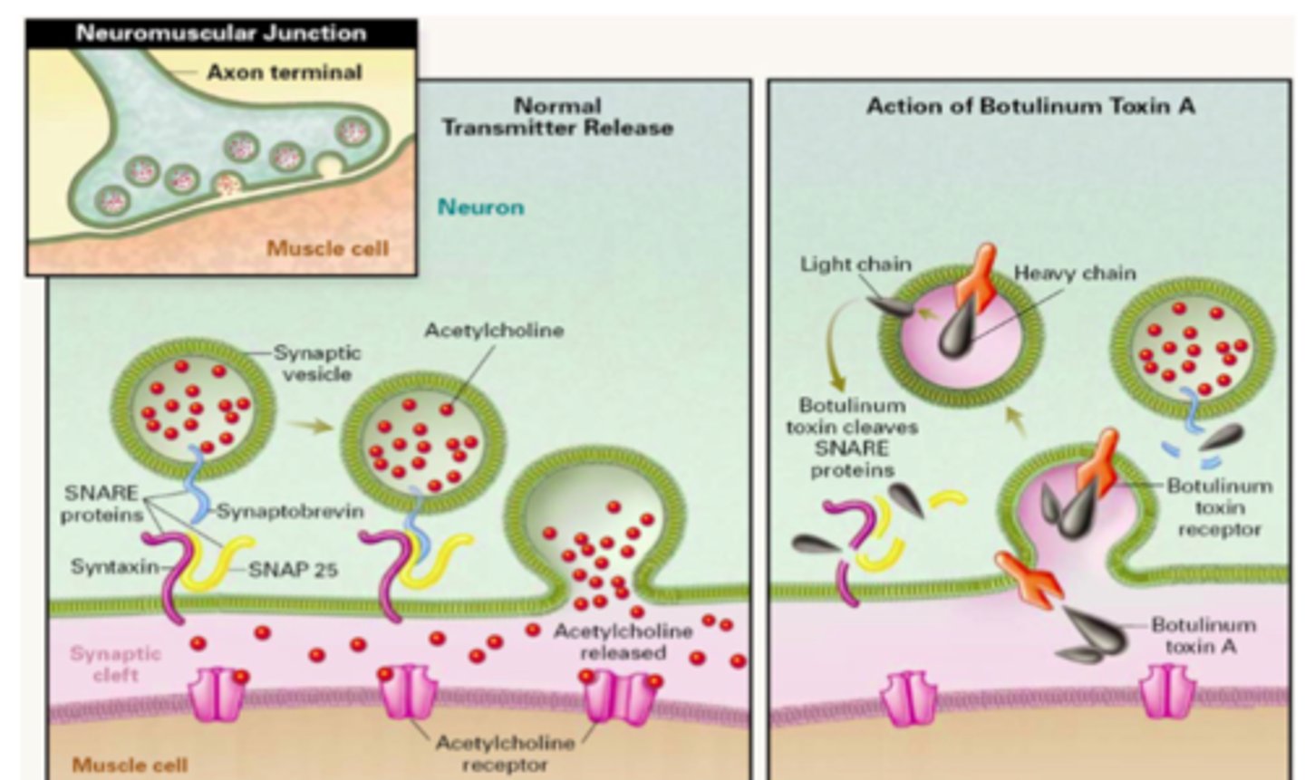 <p>• Lethal neurotoxin</p><p>(Botulinum neurotoxins (BoNTs) </p><p>• Blocks the release of acetylcholine (Ach) from presynaptic nerve terminals</p><p>– Flaccid muscle paralysis</p><p>• The fusion of AcH vesicles into the synaptic cleft is mediated by SNARE proteins, which C. botulism cleaves. So AcH cannot enter the synaptic cleft and the AcH cannot work foCr smooth muscle contraction. </p>