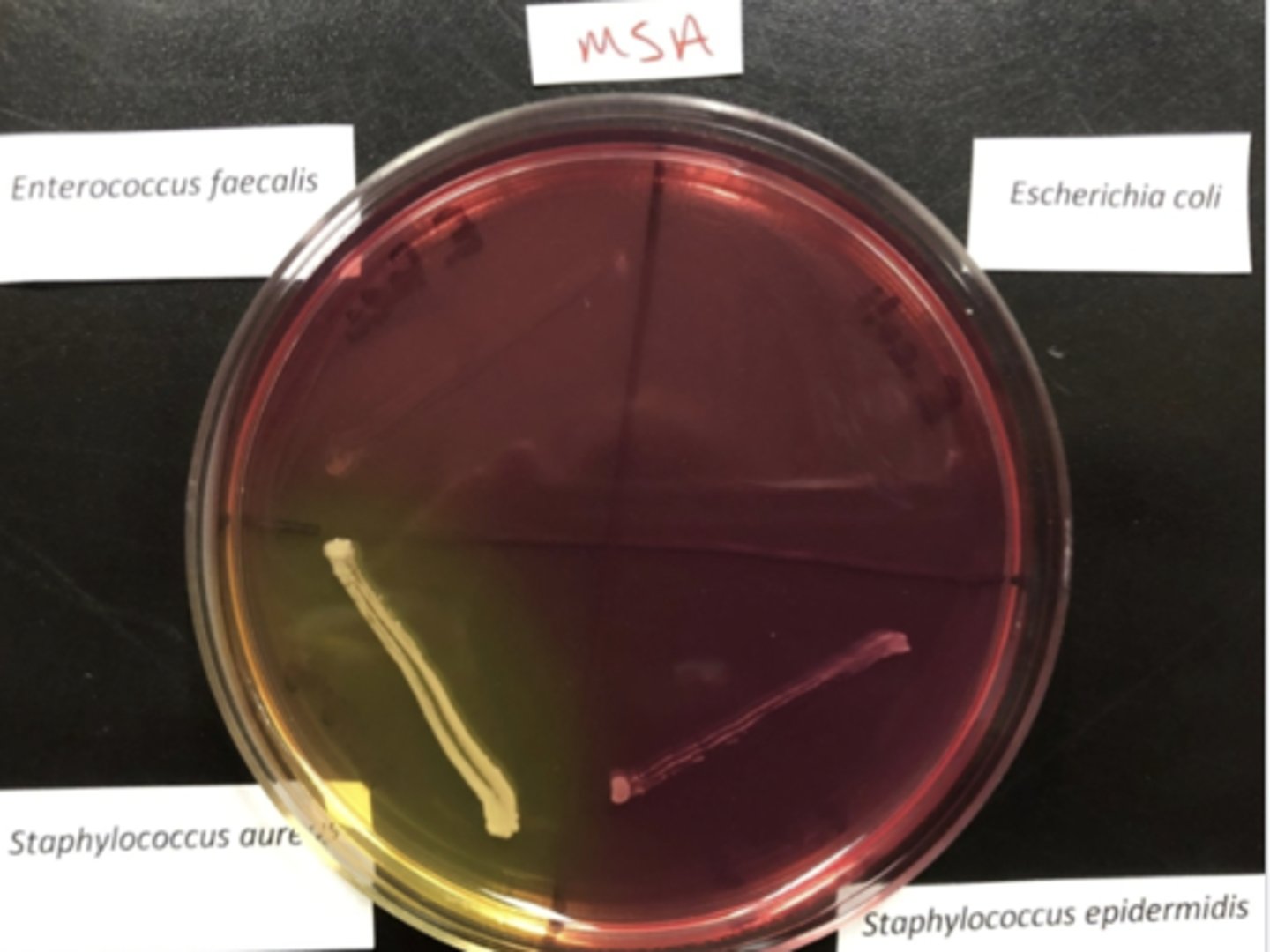 <p>Not inhibited by NaCl</p><p>- Staphylococcus other than S. aureus</p>