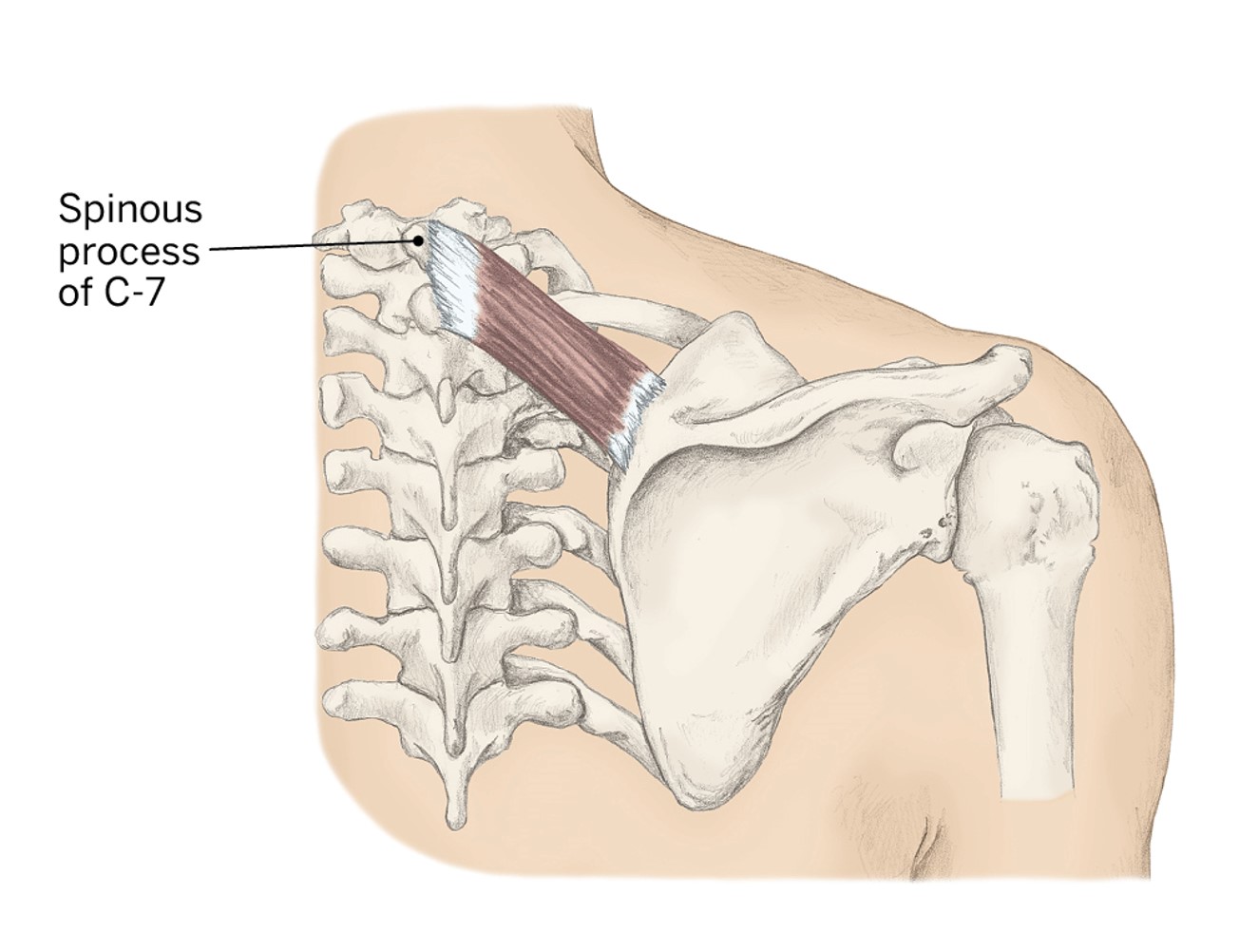<p>O- Spinous processes (C7-T5)</p><p>I- Medial Border of the scapula</p><p>A- Scapula retraction &amp; elevation</p>