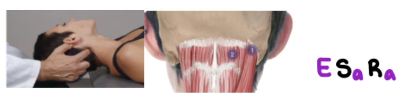 <p>Go to find inion and go inferior and more laterally to find it.</p><p>E SARA</p>