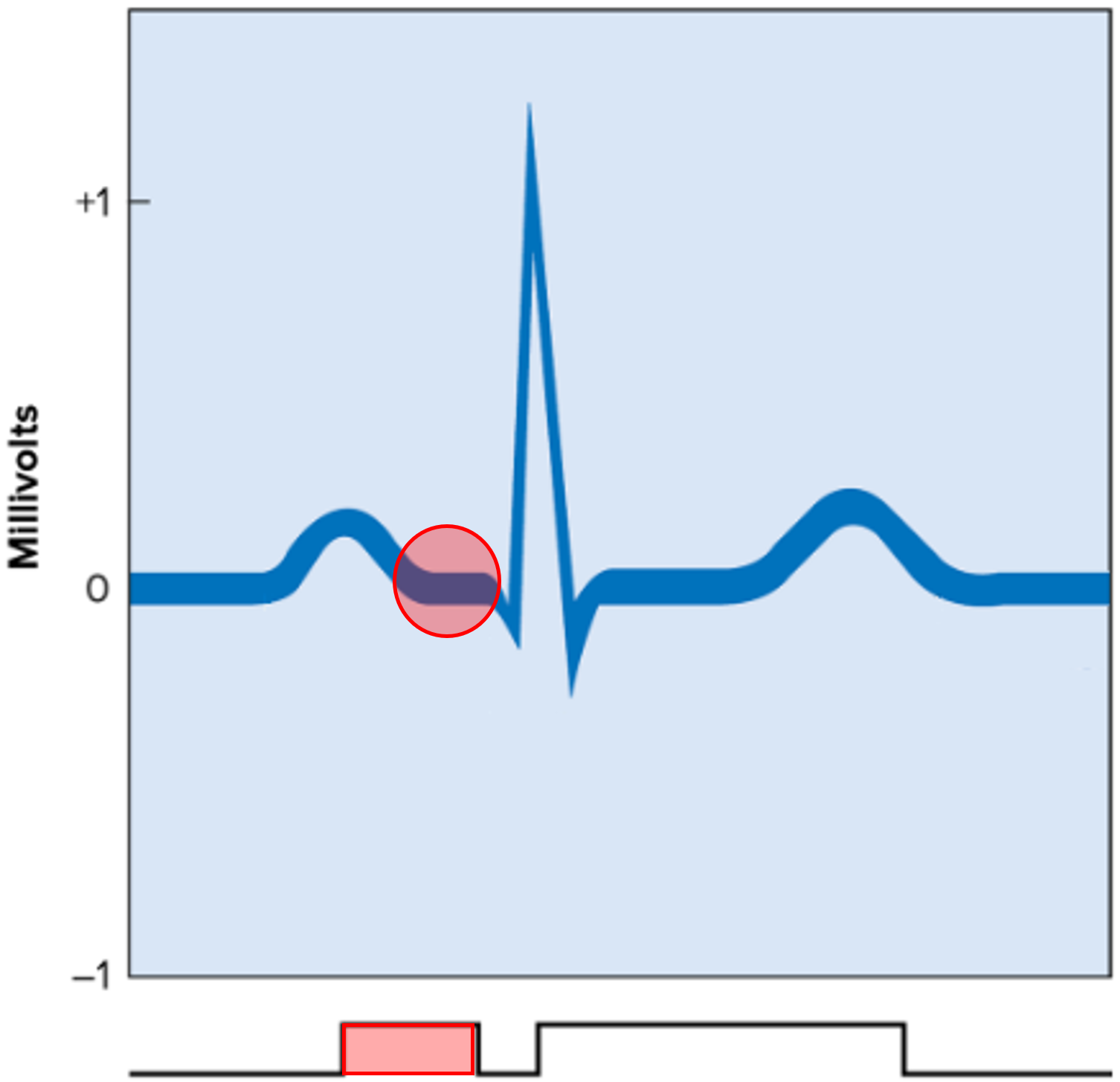 • A segment of the ECG.

• Represents atrial contraction after atrial depolarization.