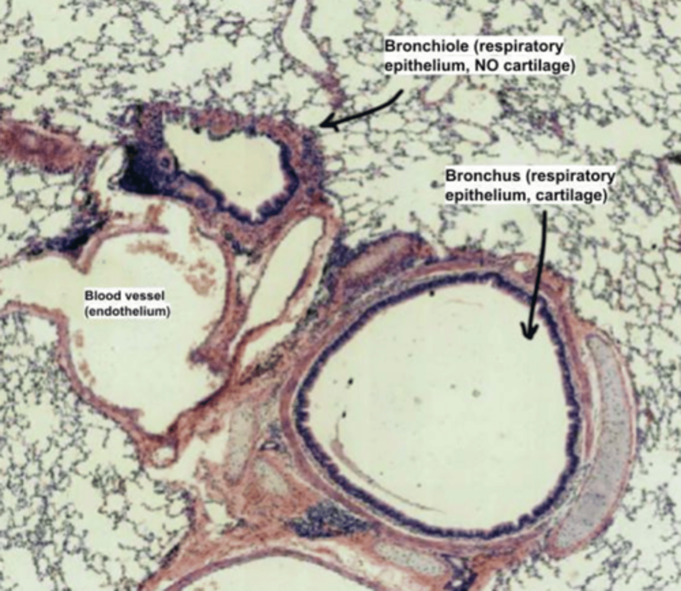 <p>. Mucosa - respiratory epithelium containing few Clara cells (they begin to replace goblet cells) +lamina propria</p><p>. Submucosa: loose - dense fibroelastic CT. </p><p>. Muscularis externa - Hyaline cartilage plates (horse-shoe shaped) + smooth muscle across the open ends of the cartilage</p><p>. Adventitia - Loose FECT anchoring the bronchus to surrounding tissue</p><p>EXTRAPULMONARY BRONCHUS portion of the bronchial tree that lies outside the lungs, before entering the lung tissue</p>