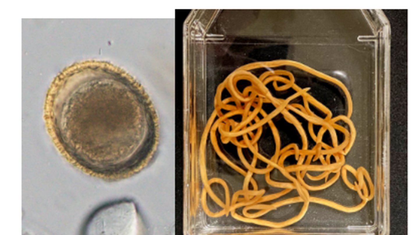 <p>Roundworm that infects SI of racoons & rarely domestic canids</p><p>-Eggs are subspherical & brown with a finely pitted outer shell, & contain a single cell that doesn't fill the egg</p><p>*Can lead to neural larva migrans & ocular larva migrans in humans</p>