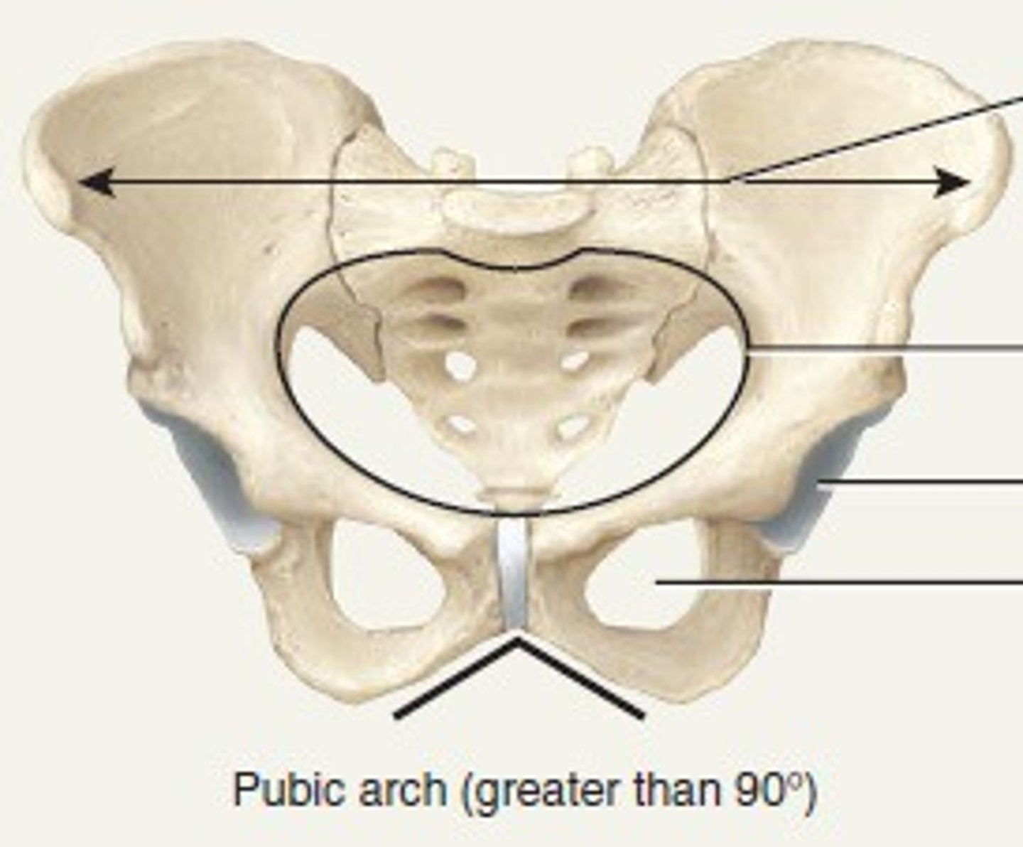 <p>wide and shallow pelvic girdle<br>pelvic arch greater than 90 degrees<br>wide sciatic notch<br>wide pelvic inlet</p>