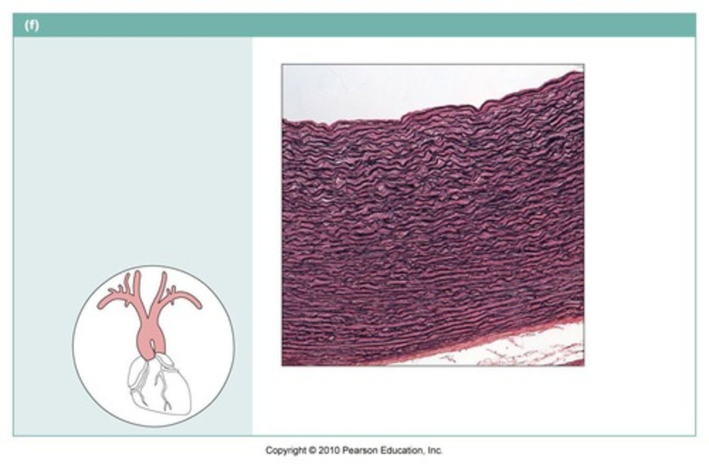 <p>Made up primarily of elastic fibers plus some collagen fibers.</p><p>It allows for strength and flexibility.</p><p>Found in the aorta and ligaments between the vertebrae</p>