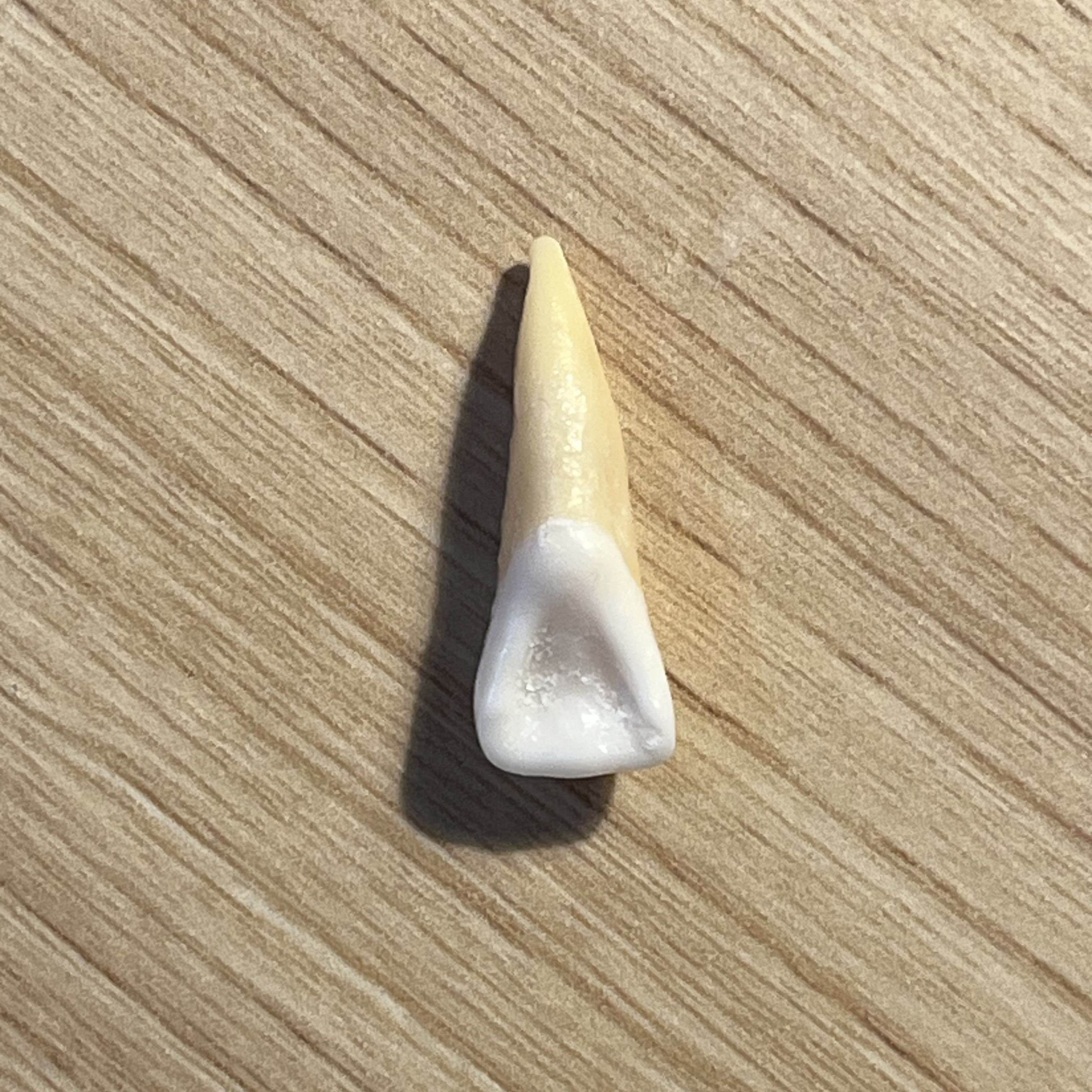 <p>What tooth is this (with view)?</p>