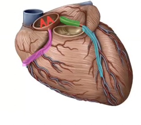<p>What terminal branch of the left coronary artery is highlighted in light blue?</p>