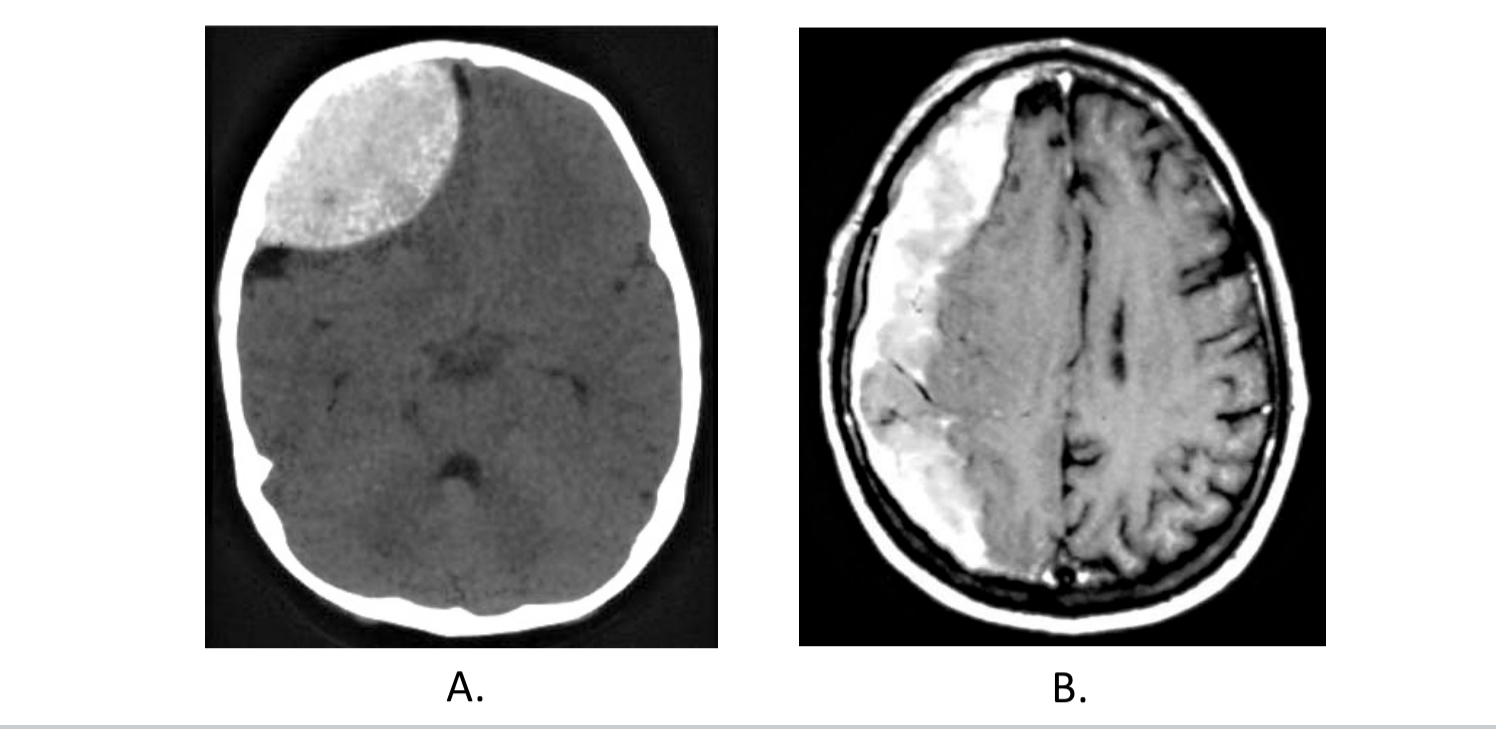 <p>What are these two conditions?</p>