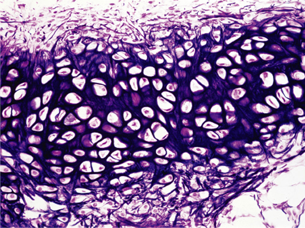 <p>Elastic cartilage</p>