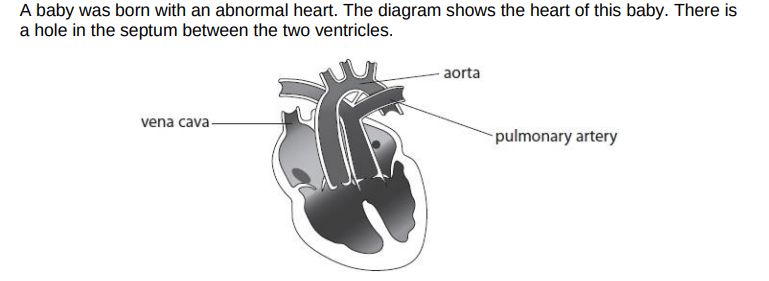<p>Problem with blood vessels</p><p>The baby survived because of the hole in the septum of the heart. Explain how the hole in the septum allowed this baby to survive.</p>