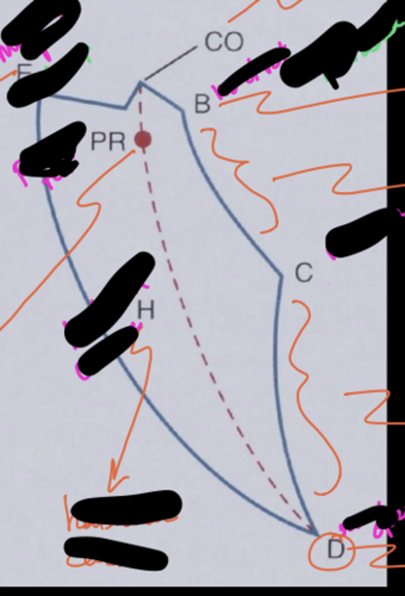 <p>Label everything, and indicate what movement occurs between BC and CD</p>