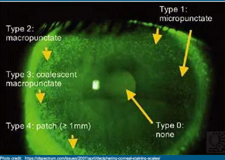 <p>Just use NaFl</p><p>Describe (diffuse, localized, etc)</p><p>Is it Punctate?</p><p>Location </p>