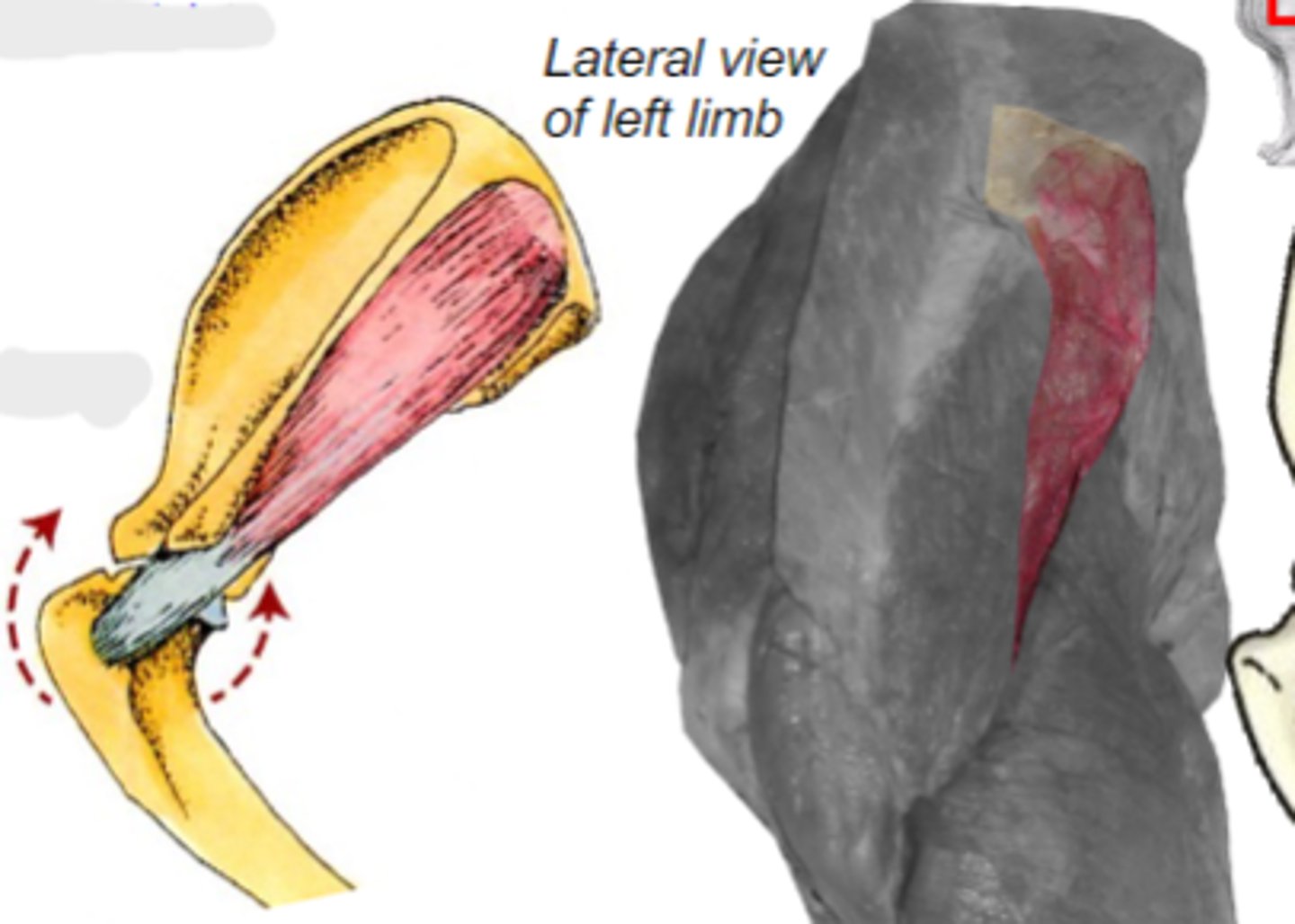 <p>Origin of infraspinatus muscle:</p>