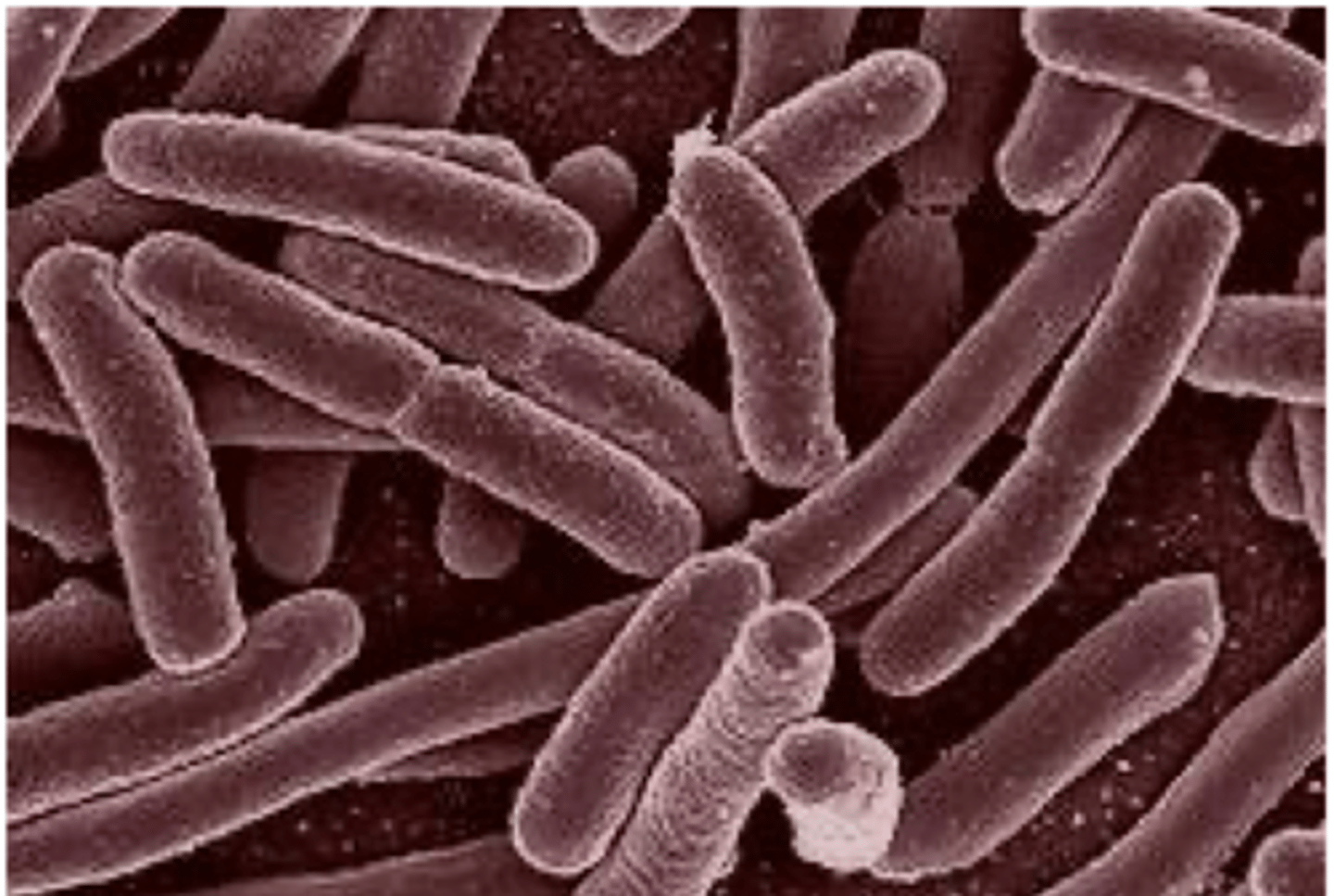 <p>Identify Pathogen causing Diarrhea:</p><p>Gram-negative rod</p><p>-Path: INVASIVE = Adheres to epithelial cells in preparation for invasion of mucosa</p><p>-Sx/PE:</p><p>&gt; Inflammatory/Bloody Diarrhea (Necrosis)</p><p>&gt; FEVER &amp; SEPSIS</p><p>&gt; Abdominal Pain</p><p>-Dx:</p><p>&gt; (+) Lactose</p><p>&gt; (+) Fecal Smear</p>