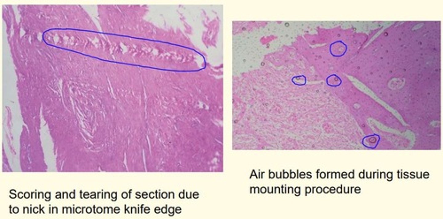 <p>1) Scoring and tearing of section = due to nick in microtome knife edge</p><p>2) Air bubble formation = during tissue mounting procedure </p>