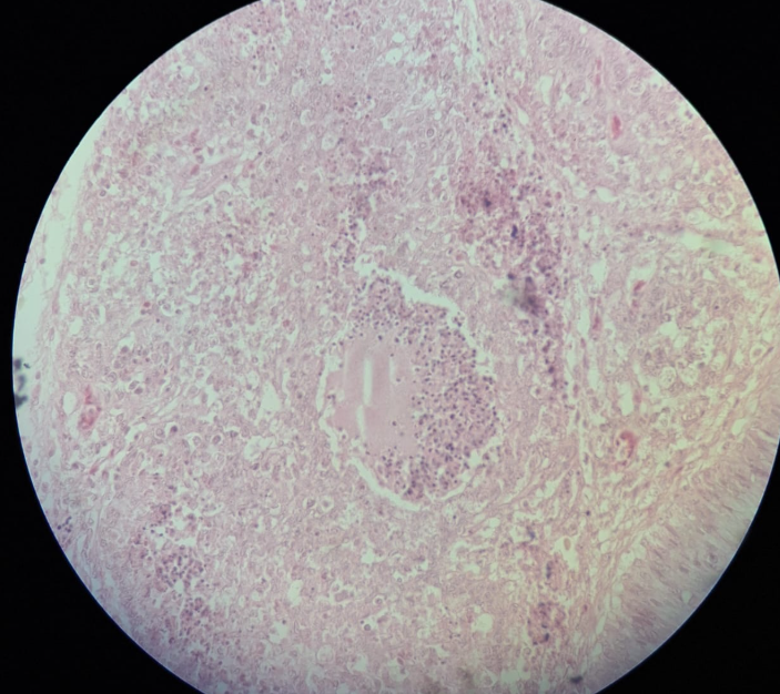 term image