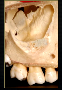 <p>underneath the surface layer of the maxilla </p>