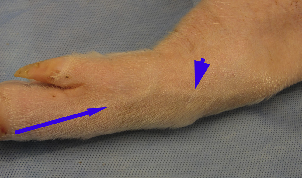 <p>What vessel is this demonstrating?</p>