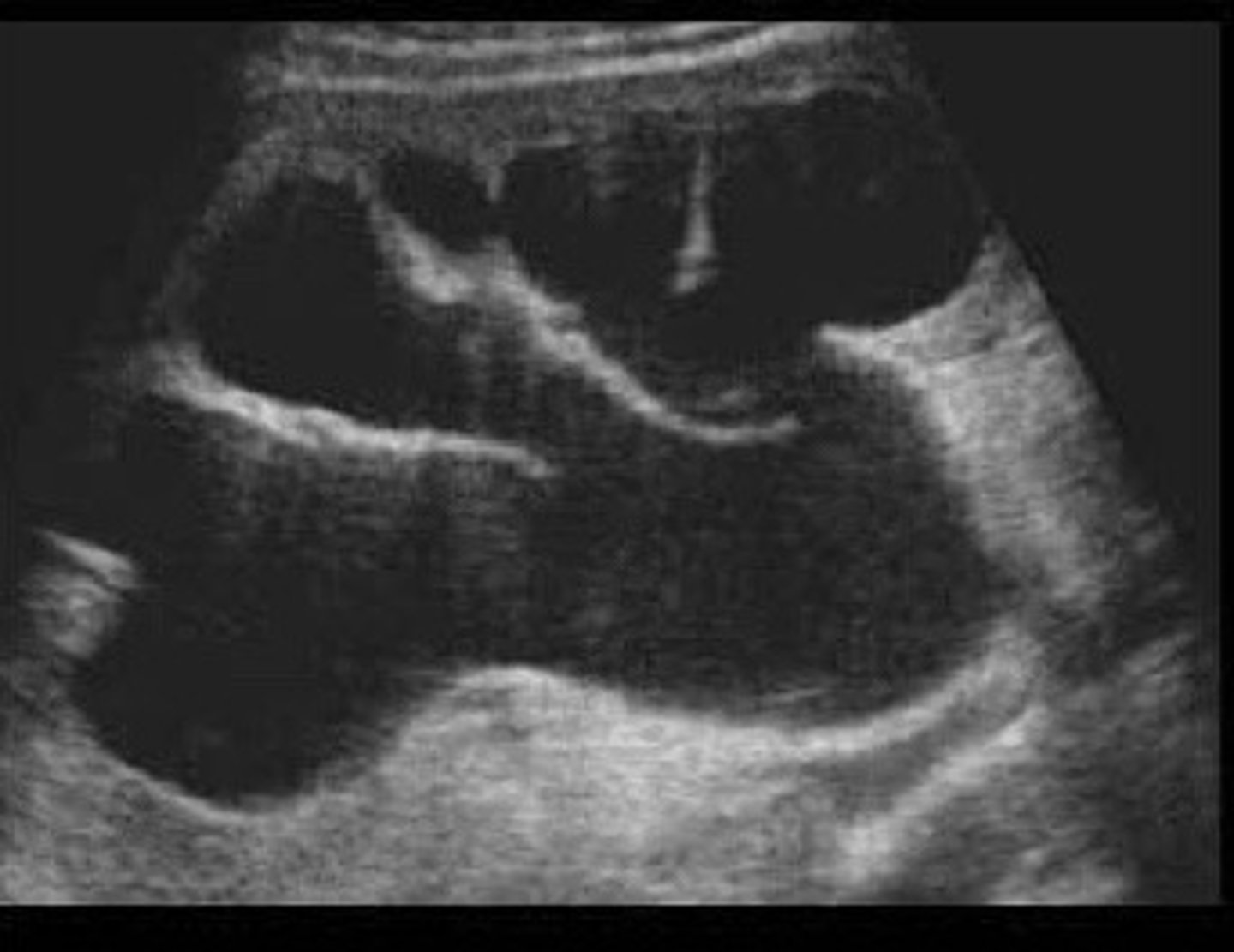 <p>What does this image show</p>