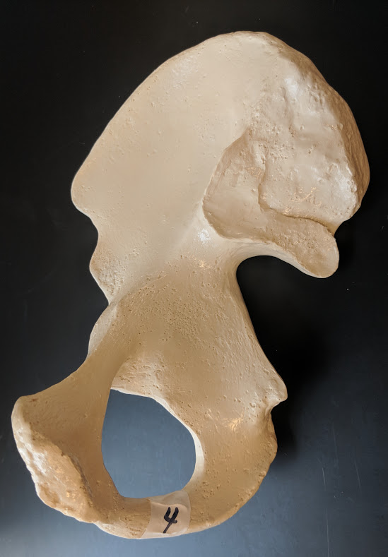 <p>Name this bone</p>