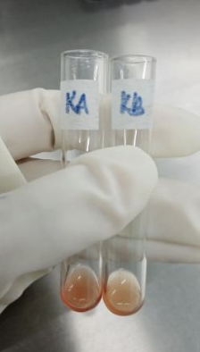 <p>Identify the:</p><ul><li><p>Blood Group</p></li><li><p>Antibody/Antibodies Present</p></li><li><p>Antigen(s) Present</p></li></ul><p></p><p>Grade the Reaction</p><ul><li><p>Known A1:</p></li><li><p>Known B:</p></li></ul><p></p>