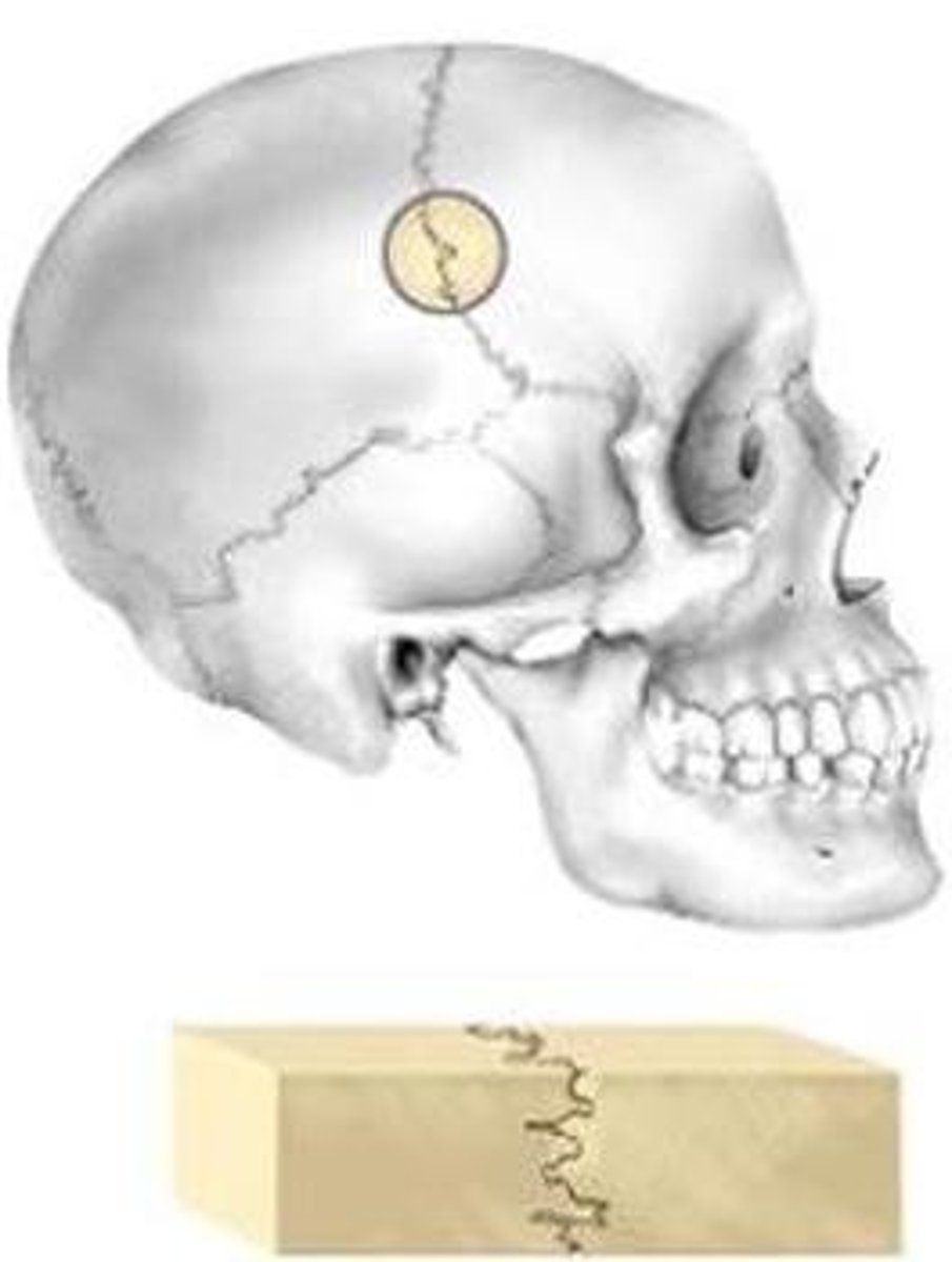 <p>inflexible joint between bones</p>