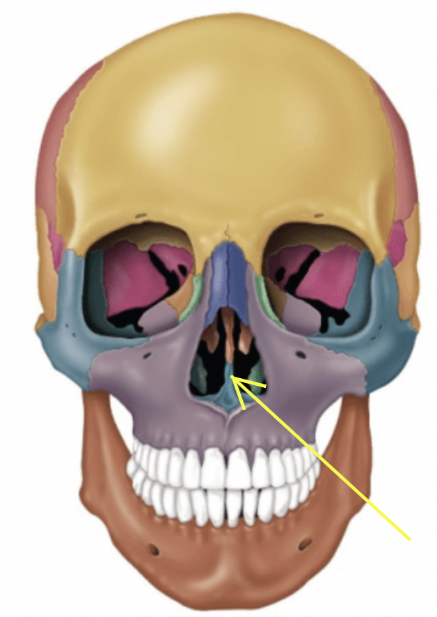 term image