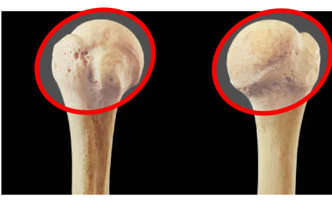 <p>Identify this part of the bone </p>