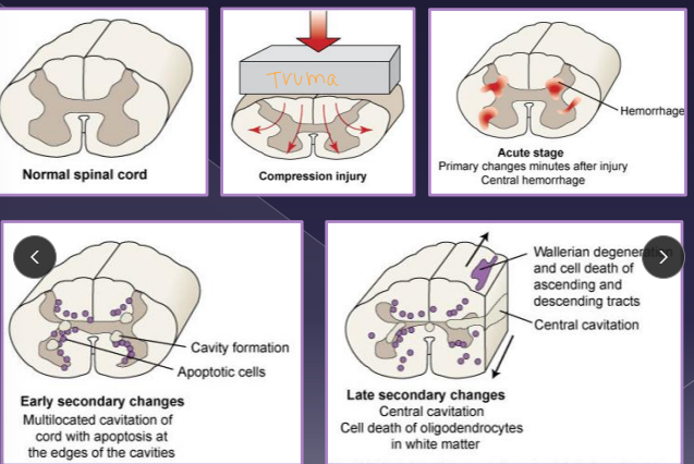 <p>Mechanisms of Trauma</p>