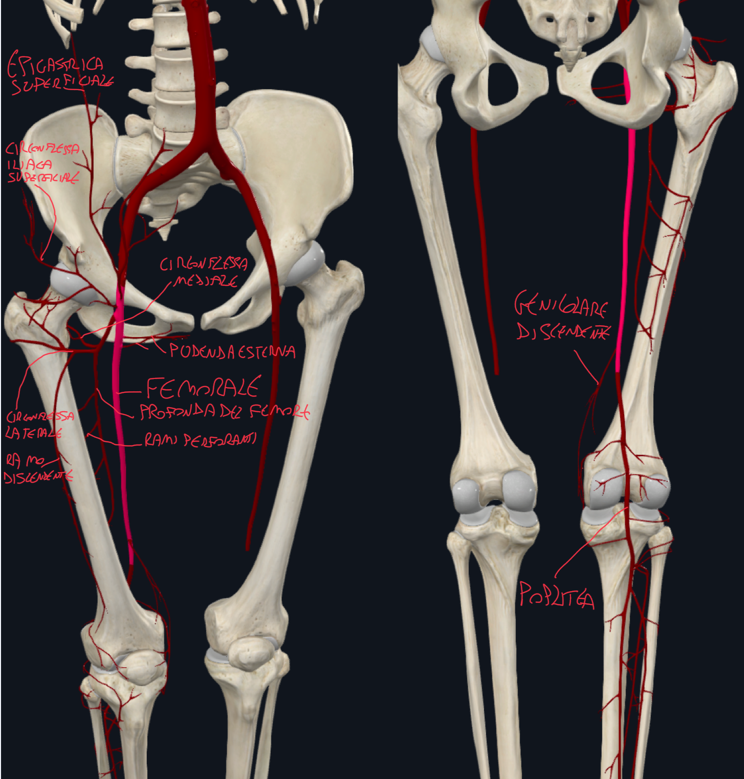 <p>Dall’arteria iliaca esterna:</p><ul><li><p>Appena superato il legamento inguinale e lo spazio retroinguinale abbiamo l’ARTERIA FEMORALE che</p><ul><li><p>Attraversa il triangolo femorale, il canale adduttorio e raggiunge la fossa poplitea dove diventa ARTERIA POPLITEA</p></li></ul></li></ul><p>Nel triangolo femorale origina:</p><ul><li><p>ARTERIA EPIGASTRICA E CIRCONFLESSA ILIACA SUPERFICIALE:</p><ul><li><p>Per parte inferiore addome e superiore coscia, passano sopra e sotto il legamento inguinale</p></li></ul></li></ul><ul><li><p>ARTERIA PUDENDA ESTERNA SUPERFICIALE E PROFONDA:</p><ul><li><p>Per la parte mediale regione inguinale e perineo</p></li></ul></li><li><p>ARTERIA PROFONDA DEL FEMORE:</p><ul><li><p>Origina dalla parete laterale dell’arteria femorale e invia:</p></li><li><p>Arteria Circonflessa Mediale del femore → per testa e collo femore</p></li><li><p>Arteria Circonflessa Laterale del Femore → con ramo discendente che partecipa all’anastomosi del ginocchio</p></li><li><p>3-4 arterie perforanti che si portano nel compartimento posteriore della coscia e si anastomizzano tra loro per vascolarizzare tutti i compartimenti</p></li></ul></li><li><p>ARTERIA GENICOLARE DISCENDENTE</p><ul><li><p>Coinvolta nell’anastomosi del ginocchio</p></li></ul></li></ul><p></p>