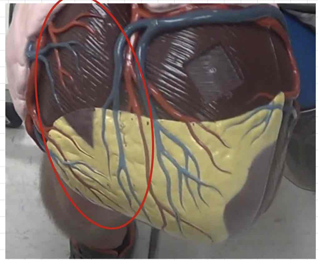 <p>what is this? (giant heart model)</p>