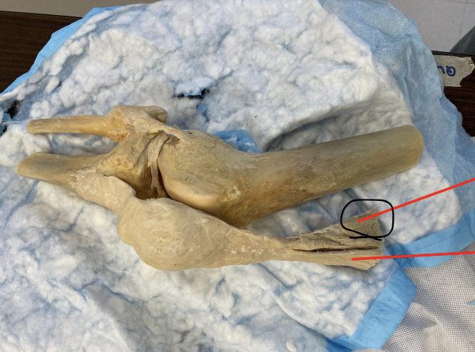 <p>identify + state origin, insertion, action, innervation of marked structure</p>