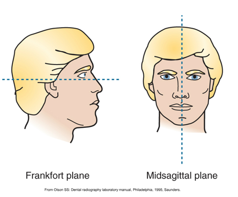 <p><span><span>·</span></span><span style="font-family: "Times New Roman"; line-height: normal; font-size: 7pt;"><span> </span></span><span><span>Is an extraoral method of radiography</span></span></p><p class="MsoListParagraphCxSpMiddle"><span><span>·</span></span><span style="font-family: "Times New Roman"; line-height: normal; font-size: 7pt;"><span> </span></span><span><span>Extraoral receptor is placed and positioned outside the mouth during x-ray exposure</span></span></p><p class="MsoListParagraphCxSpMiddle"><span><span>·</span></span><span style="font-family: "Times New Roman"; line-height: normal; font-size: 7pt;"><span> </span></span><span><span>Patient is positioned in correct manner</span></span></p><p class="MsoListParagraphCxSpLast"><span><span>·</span></span><span style="font-family: "Times New Roman"; line-height: normal; font-size: 7pt;"><span> </span></span><span><span>Receptor and tube head rotated around patient taking a series of x-ray images that will combine into one</span></span></p>