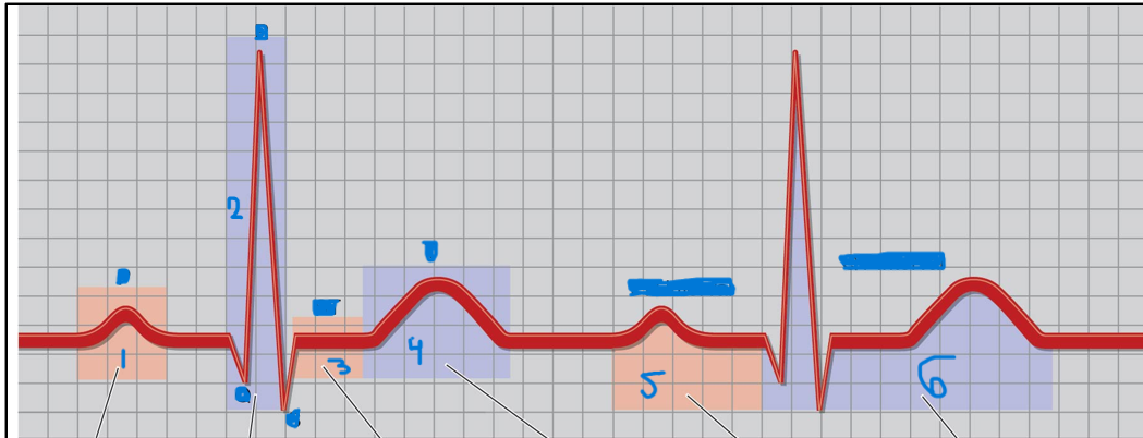 <p>Label the parts of the ECG</p>