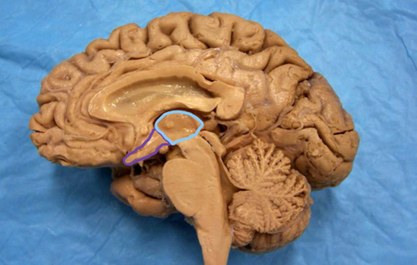 <p>identify the structures</p>