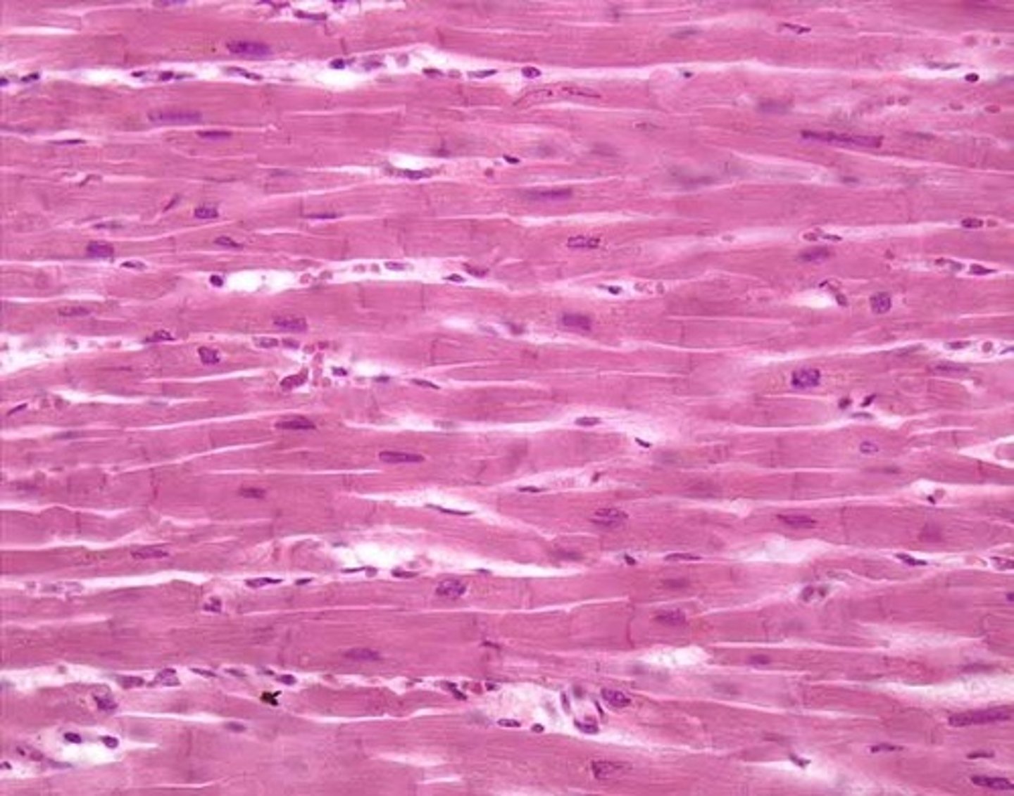<p>Cell nucleus</p><p>striations</p><p>intercalated disc/disk</p>