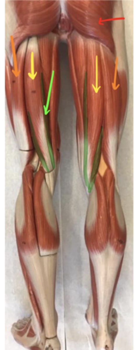 <p>ID the structure of the red arrow.</p>