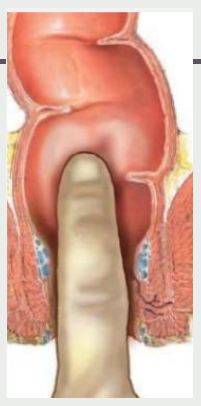 <p><strong>Prostate Exam</strong></p><p>-Have patient bend over the table or lay in the left lateral decubitus position</p><p>-With a __________ finger, gently insert into the anal _____. Flex finger anteriorly to palpate the _______ gland. Inform the patient that examining their prostate gland may prompt an urge to ________. </p><p>-Sweep your finger carefully over the prostate, identifying its lateral lobes and the groove of the median sulcus between them. Note the size, shape, mobility, and consistency of the prostate, and identify any masses/tenderness/enlargement. </p><p>-The normal prostate will be ________ and nontender</p><p>-If possible, extend your finger above the prostate to the region of the _______ vesicles and the peritoneal cavity and sweep the anterior wall. Note any nodules or tenderness</p><p>-Gently withdraw your finger, and wipe the anus or give the patient tissues </p>